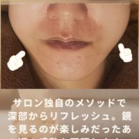 木更津市のエステサロンBeauty Salon EST独自メソッドによるフェイシャル施術のBeforeAfter比較写真