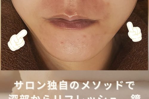 木更津市のエステサロンBeauty Salon EST独自メソッドによるフェイシャル施術のBeforeAfter比較写真