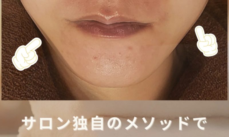 木更津市のエステサロンBeauty Salon EST独自メソッドによるフェイシャル施術のBeforeAfter比較写真